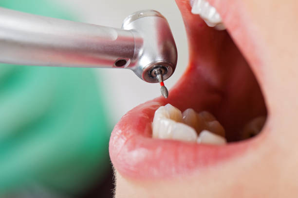 Best Pediatric Emergency Dentist in Crownpoint, NM